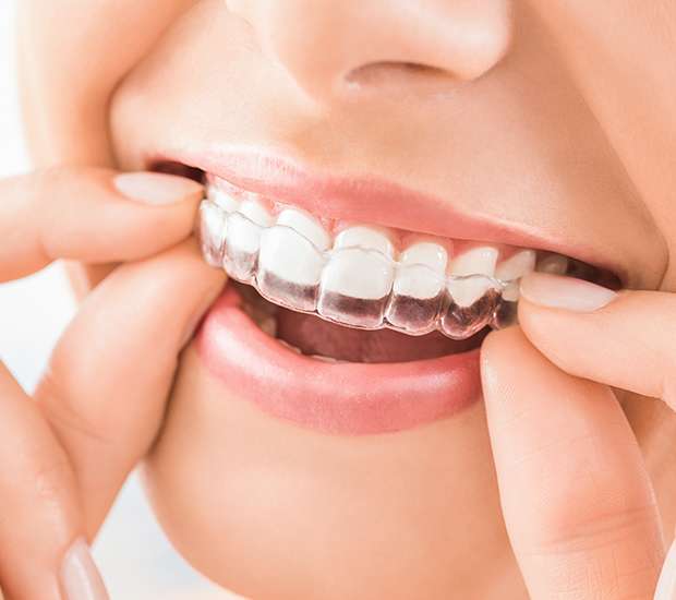 Scottsdale Does Invisalign Really Work